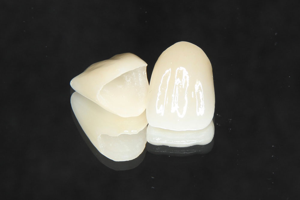 ジルコニアクラウン