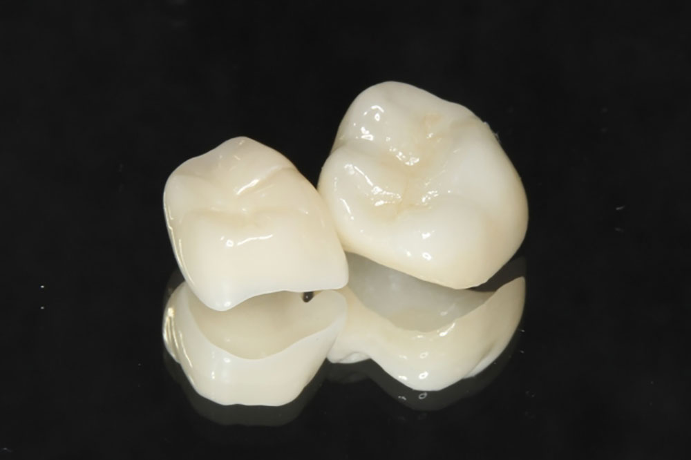 ハイブリッドセラミック