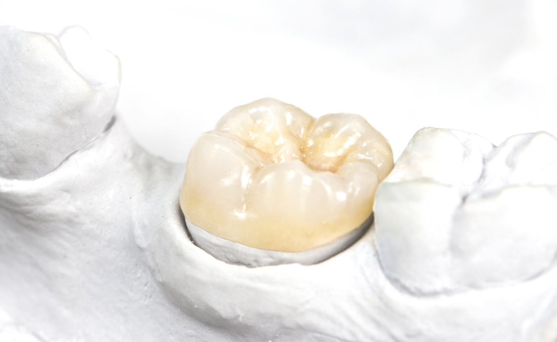 快適な噛み心地・精密な技工物